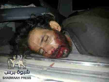 بيان نعي وإدانة ومساندة من قبيلة آل دغار كنده لقبيلة الصيعر