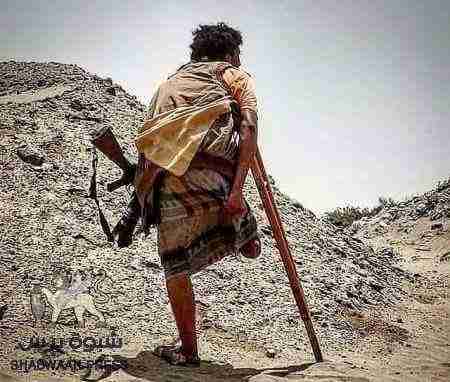 إعلان لكل من فقد أطرافه في الحرب مراجعة إئتلاف المقاومة الجنوبية بعدن لعلاجه بالسعودية