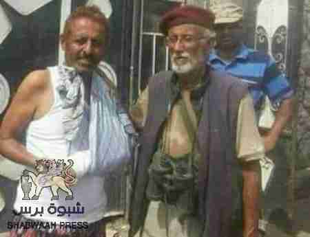 كاتبه يمنية تخاطب التحالف العربي : حقيقه &lsquo;&lsquo;حزب الاصلاح وسرقة البطولات&lsquo;&lsquo;