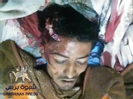 استشهاد جندي واصابة آخر في هجوم لعناصر القاعدة على نقطة أمنية في أبين(صور)