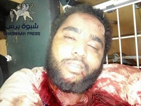 قوات الأمن بلحج تقتل ‘‘أبو علي اللحجي‘‘ اكبر قيادات تنظيم القاعدة بالمحافظة (صور)