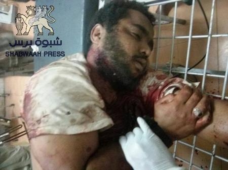 من هو ‘‘عمار قائد‘‘ القيادي في تنظيم القاعدة بلحج الذي لقي مصرعه يوم أمس ؟