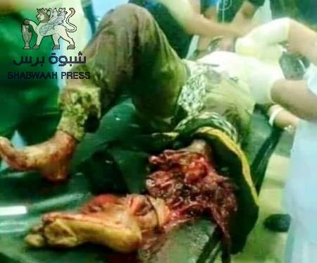 في حضرت الأبطال الشرفاء : على ‘‘حسين عرب‘‘ أن يقول حسنآ أو فليصمت !!