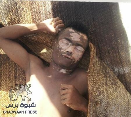 العثور على جثة مجهول بالتواهي وعليها آثار تعذيب شديد