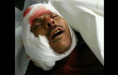 الوضع بتعز بات مرعباً ومخيفاً للغاية.