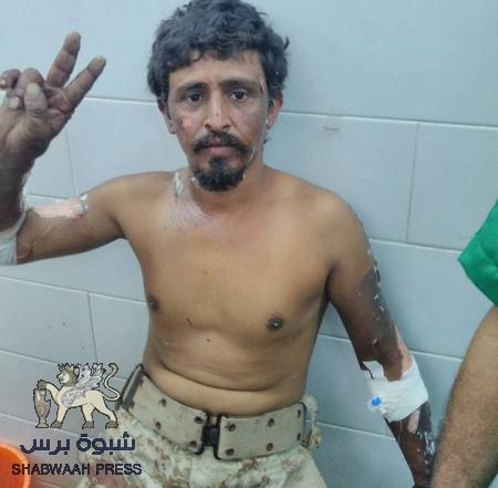 سيارة مفخخة تستهدف طقم للحزام الأمني في مودية وإصابة 7 جنود (صور وأسماء)
