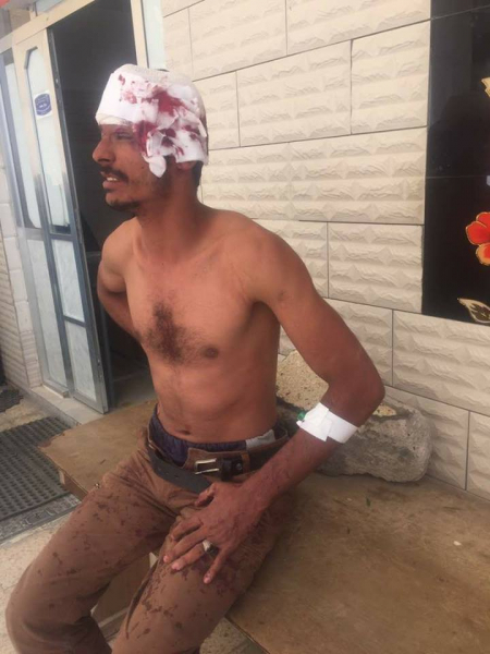 القعيطي يتعرض لحادث مروري في يهر يافع