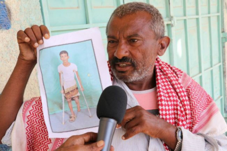 معاملة قاسية تلقاها مقاوم بترت قدمه : حرم من العلاج والطرف الصناعي .. وترك يواجه مصيره !!