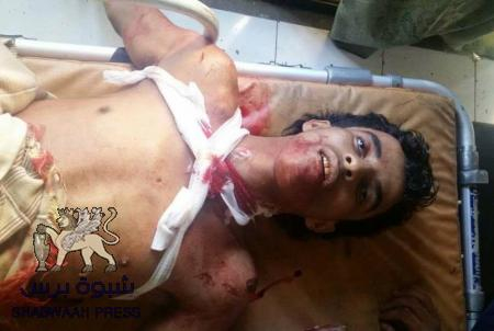 مليشيا الاصلاح تقاتل مقاومة السلفيين والإنقلابيين يتعاطون القات بجوارهم