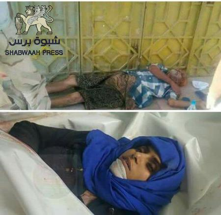 صورتين لجريمتين صد الإنسانية في اليمن