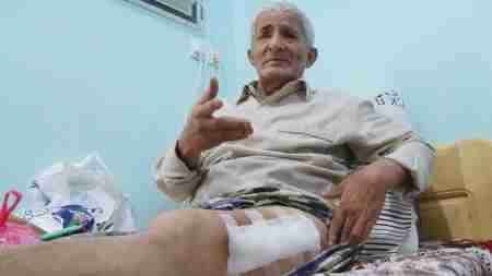 جريح حرب عدن علي السعدي يناشد اولاد زايد وأهل الخير انقاذ حياته