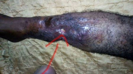 على الرئاسة وجهات علاج جرحى الحرب تحمل مسئولياتهم قبل فوات الأوان