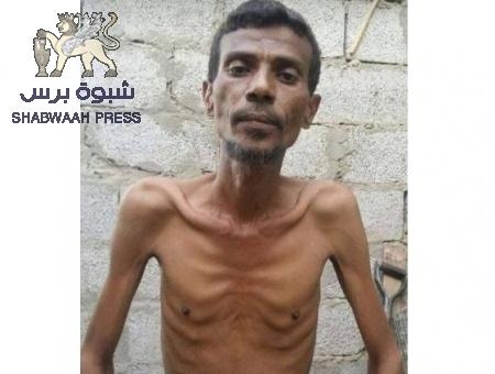 وفاة فنان يمني تهامي من الجوع في الحديدة