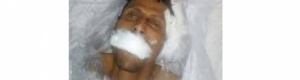 مقتل نازح من الحـديدة في مأرب هرب من رصاص الحرب وسلطات المحافظة لم تحرك ساكنا