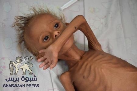 كلمة حق لابد منها : لقد طفح الكيل،والواقع في المناطق المحررة لايطاق