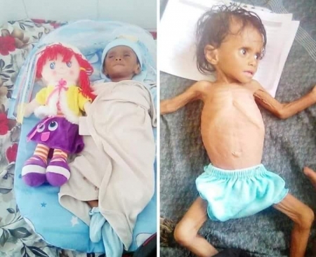 سياسي وبرلماني : بعد وفاة الطفلة &lsquo;&lsquo;هند&lsquo;&lsquo; جوعا.....هل يخجل هؤلاء؟؟