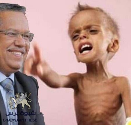 مخاطبا جنوبيي الشرعية .. شطارة : اما تقفوا مع شعبكم اليوم واما ستكونوا شركاء في سياسة تجويع أهلكم