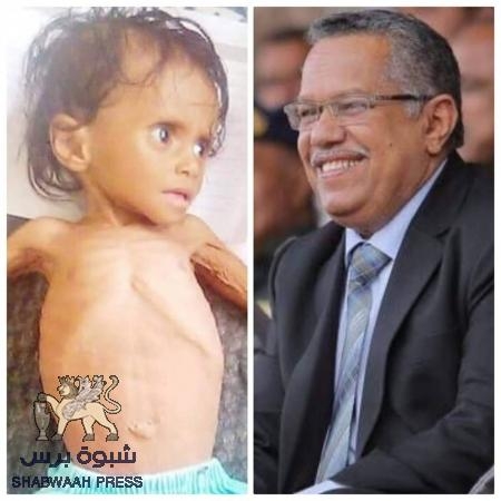 نشطاء وإعلاميون يبكون رحيل &lsquo;&lsquo;الطفلة هند&lsquo;&lsquo;..أصغر شهداء حكومة الجوع