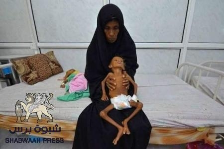 شطارة : الانتقالي الجنوبي حذر التحالف من مخطط حكومة الشرعية