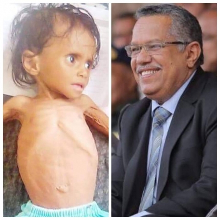 بن دغر يتهرب من مسؤولية حكومته عن الإنهيار ويحملها تجار النفط ويلمح إلى #التحـالف_العربي