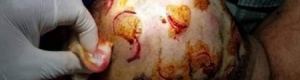 جنود الحماية الرئاسية يعتدون على طالب جامعي ويضربونه رأسه بآلة حادة بسبب موقفه الرافض للشرعية (صور)